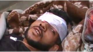 أحد جرحي التريمسة