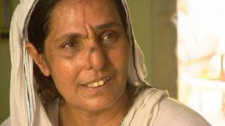 A paquistanesa Allah Rakhi, após a cirugria que lhe deu um nariz novo (BBC)