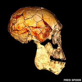 Reconstrucción con tomografía del cráneo 1470 y el nuevo maxilar 6000, ambos encajan perfectamente