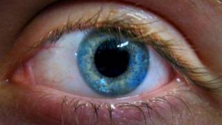 Ojo
