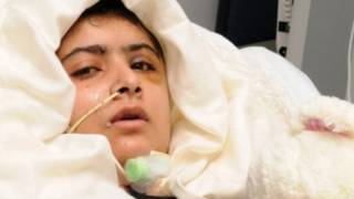 Malala Yusufzai