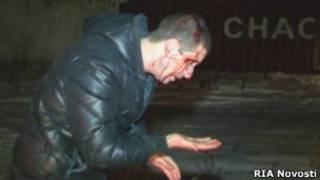 Мужчина, пострадавший при задержании у стен колонии в Копейске