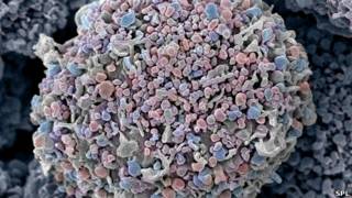 Células cancerígenas