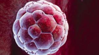stem cell
