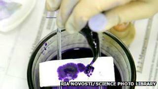Test de laboratorio