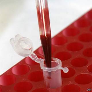 Exame de sangue (AP/Arquivo)
