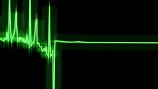 Electrocardiograma