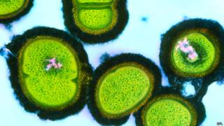 Staphylococcus aureus bacteria