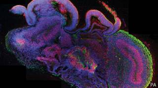 Cerebro miniatura