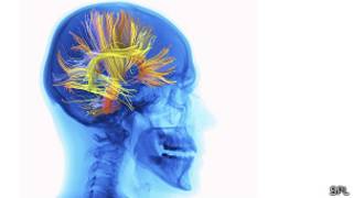 Materia gris del cerebro