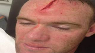 wayne rooney ya ji rauni