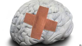 Daño cerebral