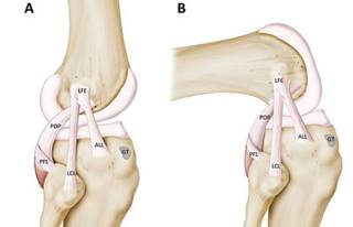 O novo ligamento indicado pela sigla de seu nome em inglês, ALL (Foto: Hospital da Universidade de Leuven)