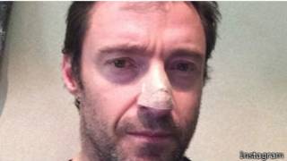 Jackman en Instagram