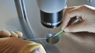 IVF