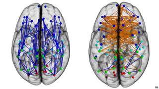 Conexiones cerebrales de hombres y mujeres