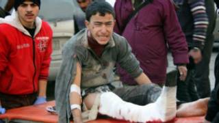 Abakomerekeye mu gitero mu mujyi wa Aleppo