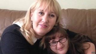 Amy e Jayne Hughes | Crédito: BBC