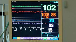 Monitor de batimentos cardíacos em hospital (Arquivo/PA)