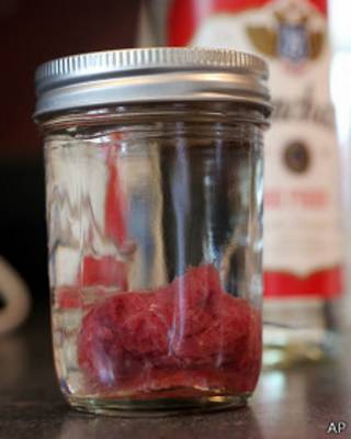 Placenta