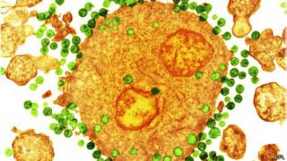 HIV
