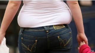 Obese woman