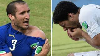 Mordisco de Suárez