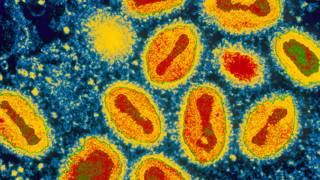 Varíola (Smallpox (EYE OF SCIENCE/SCIENCE PHOTO LIBRARY))