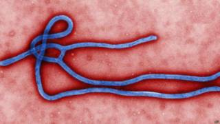 Virus del ébola