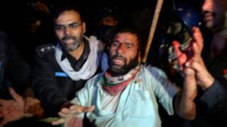 Wasu da suka jikkata a Pakistan