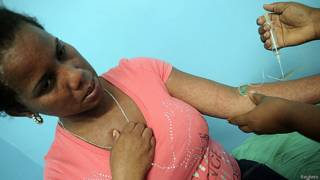 Mujer siendo tratada contra el chikungunya