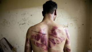 Sirio víctima de tortura