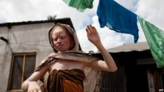 Bamwe mu bapfumu batekereza ko ibice by'imibiri y'abanyamweru izana ubukungu