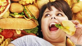 Obesidad