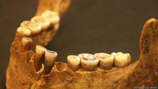 Dentadura de la Dama Roja