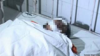 लड़की की घायल मां