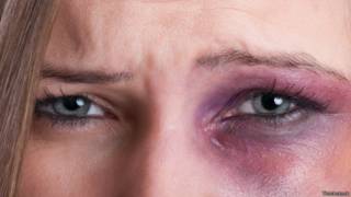 Thinkstock