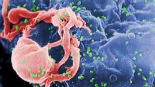 Virus de inmunodeficiencia adquirida