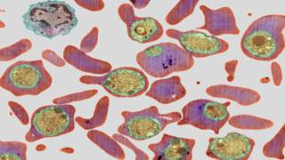 malaria