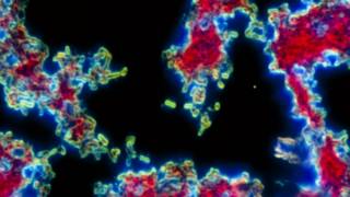 La bacteria causante de la peste bubónica.