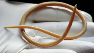 دودة الاسكارس "يمكن أن تزيد الخصوبة عند النساء" - BBC News Arabic