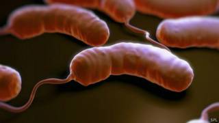 tanzania cholera