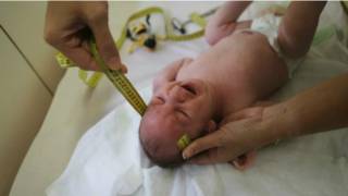 Un bebé en una consulta médica
