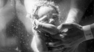 La foto ganadora, de un bebé recién nacido en un parto de agua
