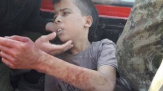 عبد الله عيسى لاجئ فلسطيني لا يتعدى سنه 12 عاما وهو من عائلة فلسطينية لاجئة في سوريا