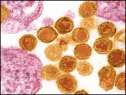 ¿El cáncer de próstata causa fatiga? ¿El cáncer de próstata causa fatiga?