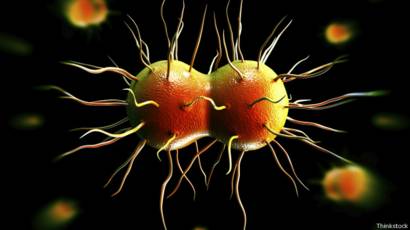 la vaginosis bacteriana puede causar dolor pélvico la vaginosis bacteriana puede causar dolor pélvico