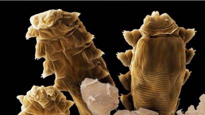 microscopio de ácaros
