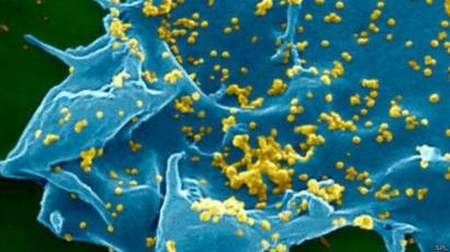 чем опасен коронавирус mers чем опасен коронавирус mers