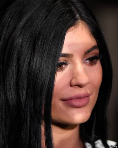 Los Riesgos Del Dilatador De Labios Por Succion La Ultima Moda